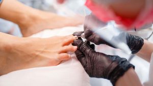 ingrown toenails Worthing